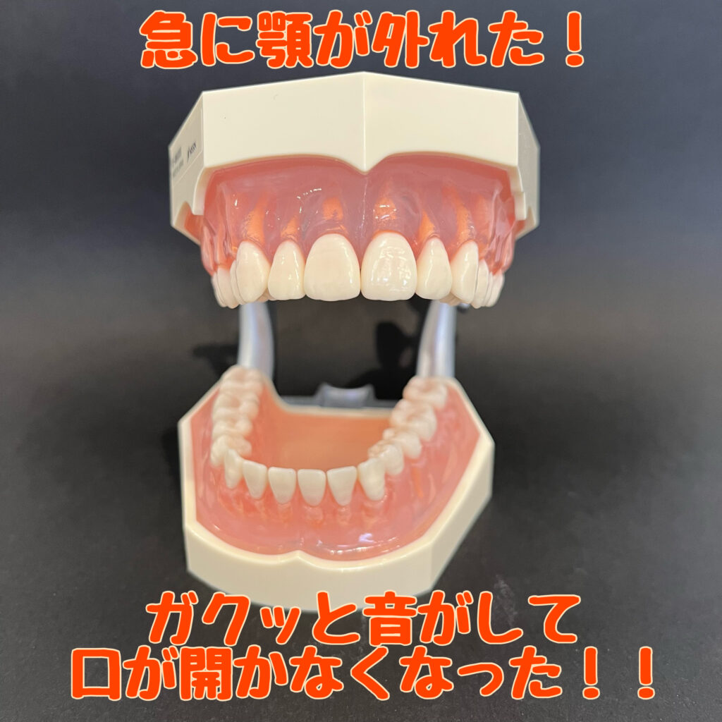 あくび 顎 が 外れ そう _ あくびをすると顎が痛い – Kacte Online
