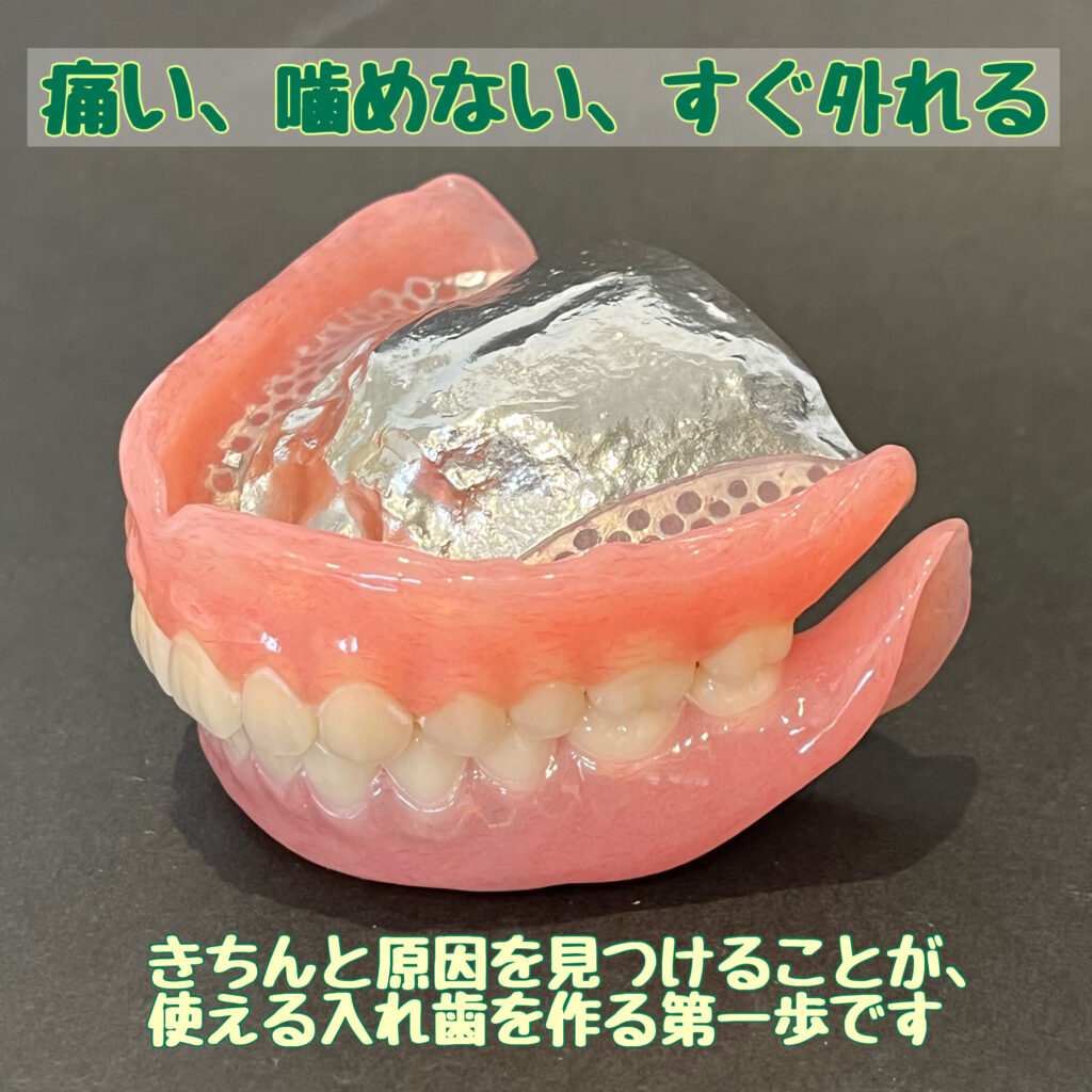 義歯（入れ歯）治療のご案内 - 【大森歯科医院｜岡山県総社市の歯科医院です】