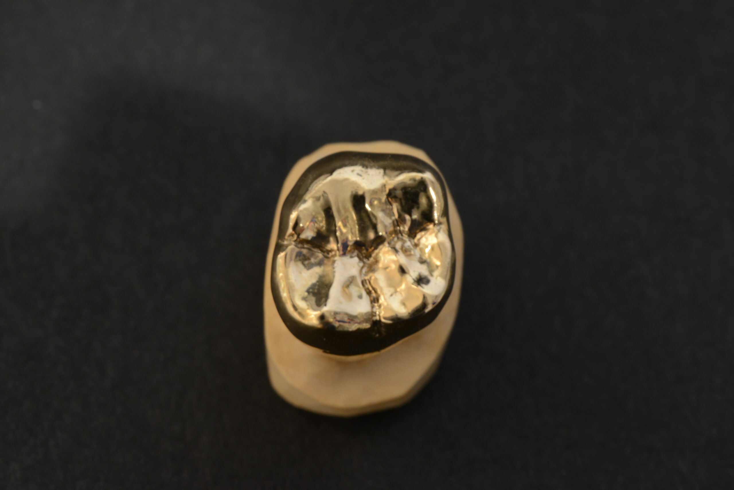 ま*き様 歯医者解体現場にて 金歯？材質不明 詳細不明 金属 材料 20g ま*き様 歯医者解体現場にて 金歯？材質不明 詳細不明 金属 材料 20g